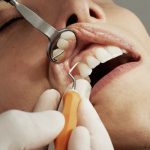 Local SEO Services for Dentists