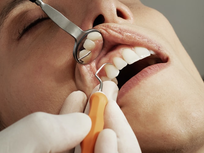 Local SEO Services for Dentists