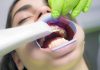 Local SEO for Dentists