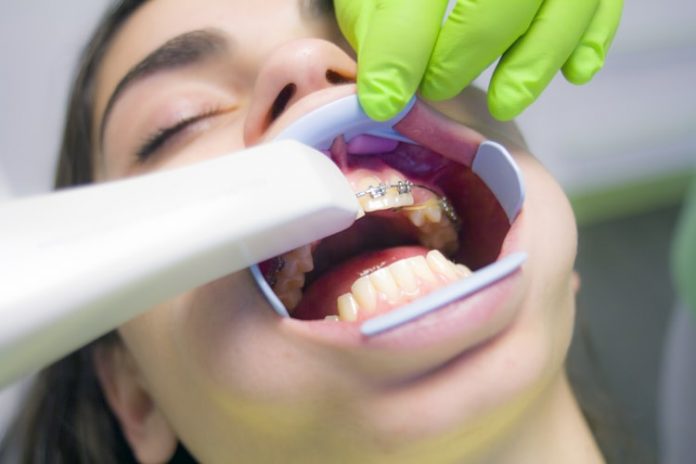 Local SEO for Dentists